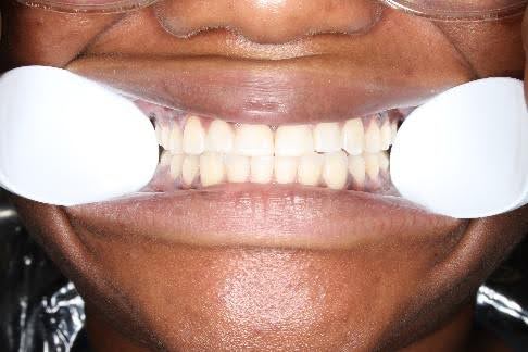 photo1 Wheeler Orthodontics