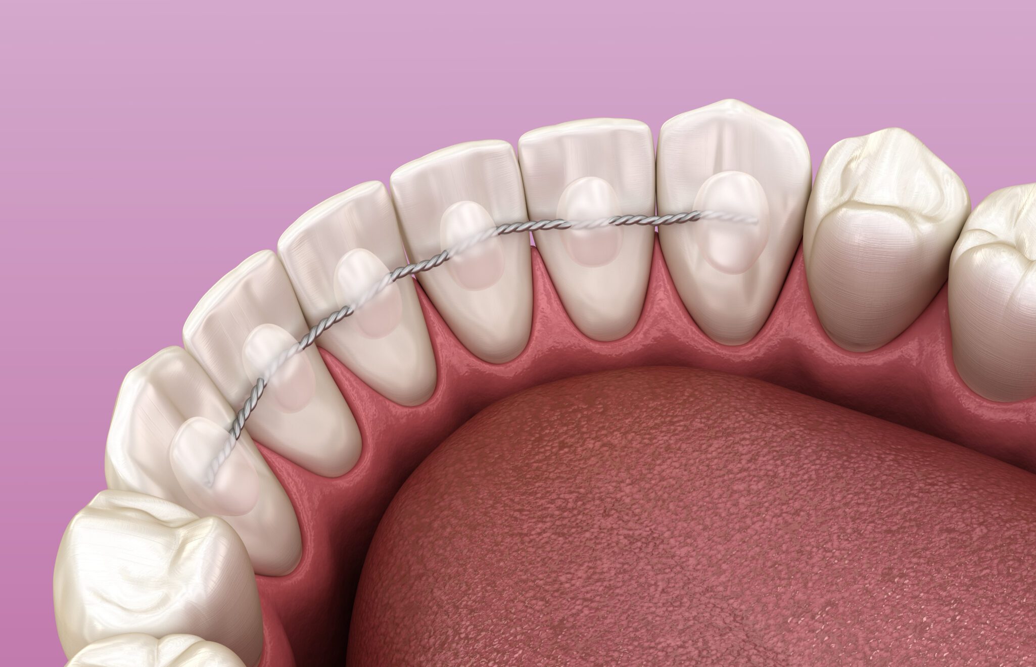 Orthodontic Treatment in Toldeo